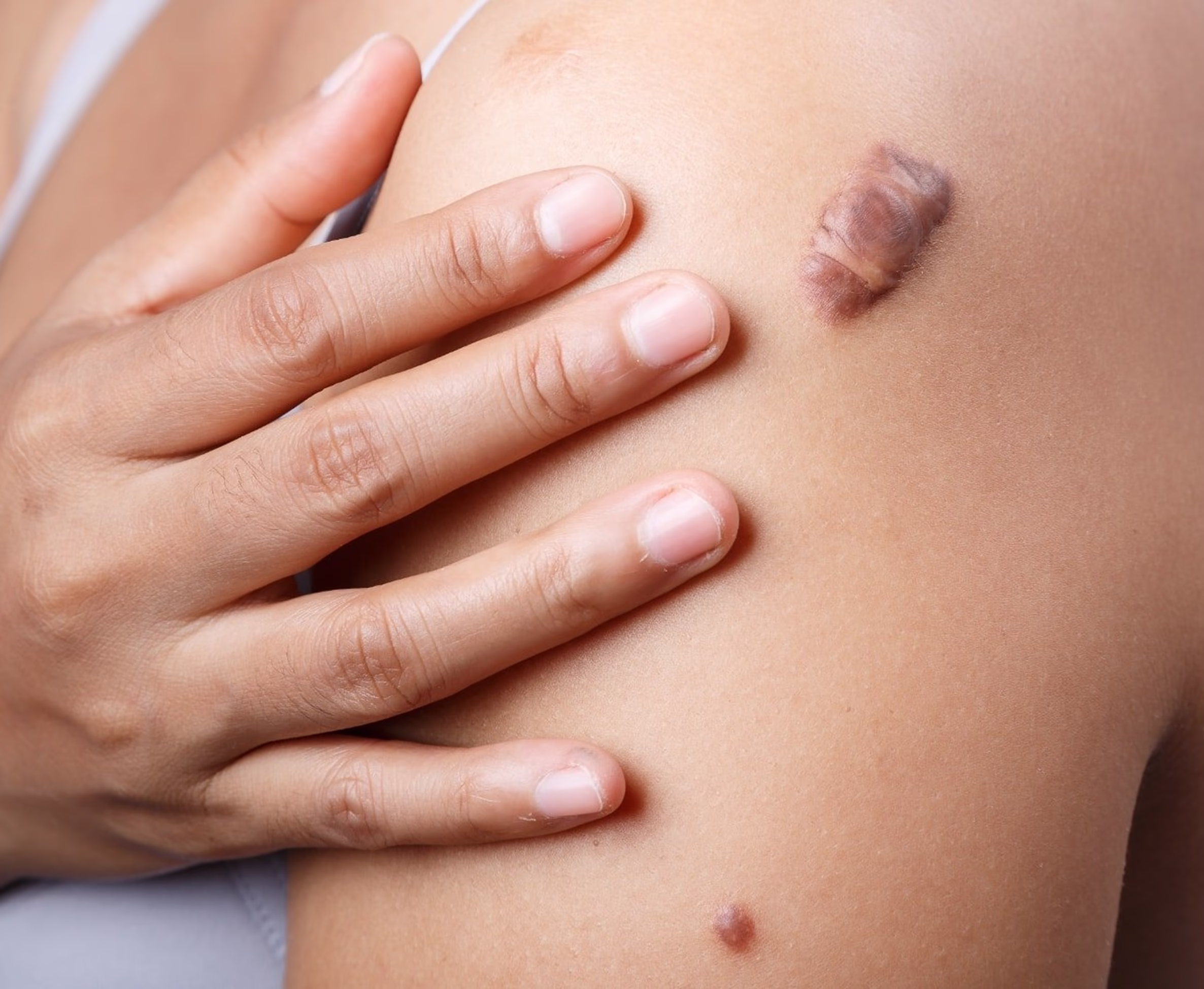 Grenz Ray Therapy Device