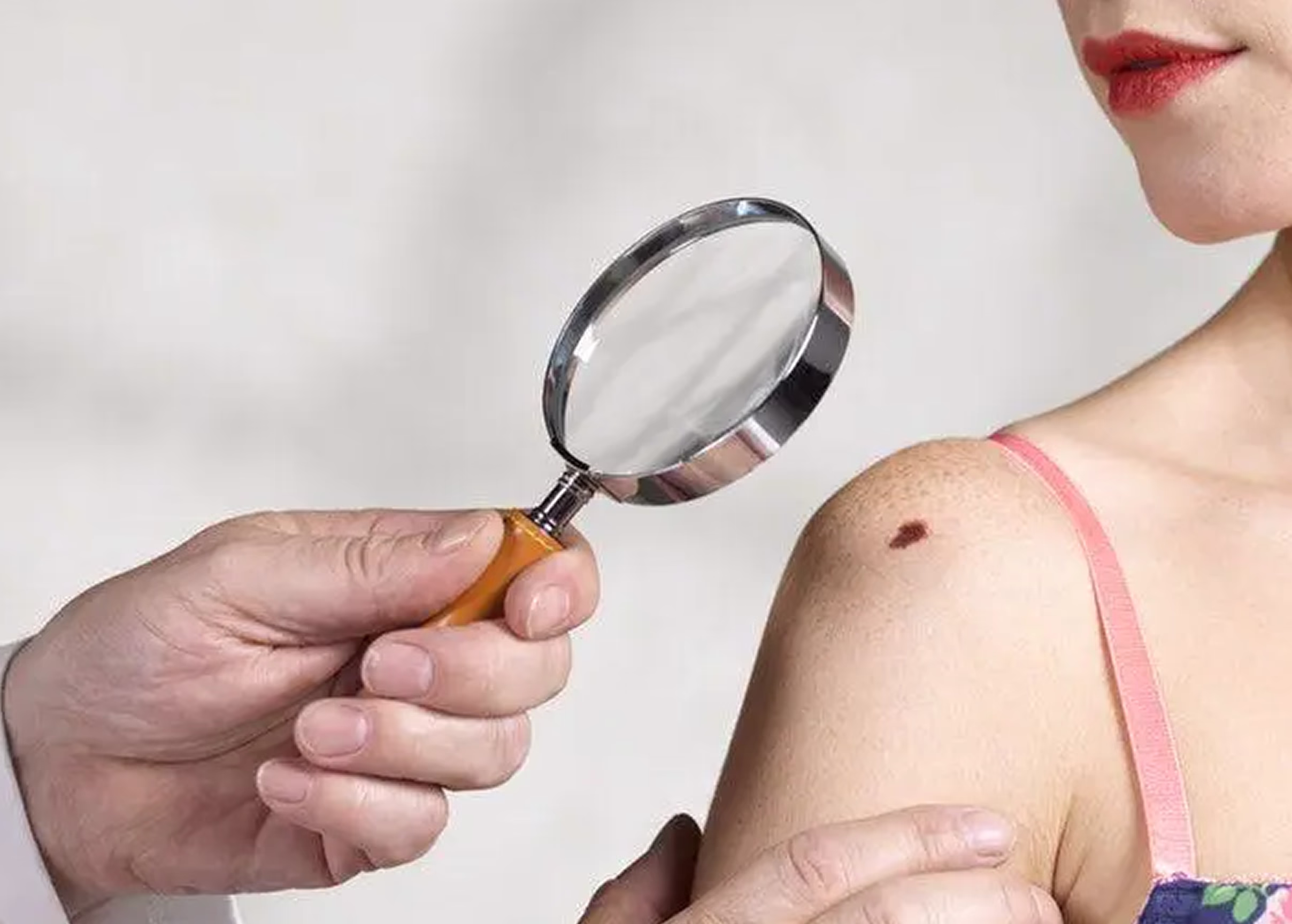 Doctor examining skin with magnifying glass