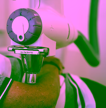 SXRT treatment device used in superficial radiation therapy