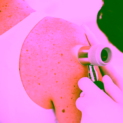 Skin cancer screening examination