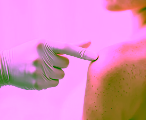 Skin cancer treatment examination on patient